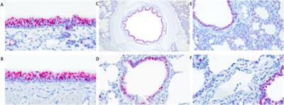 Pigs lacking TMPRSS2 displayed fewer lung lesions and reduced inflammatory response when infected with influenza A virus